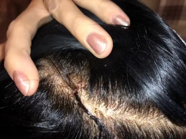 Ссора матерей в детском саду из-за удаления из группы в мессенджере завершилась поножовщиной