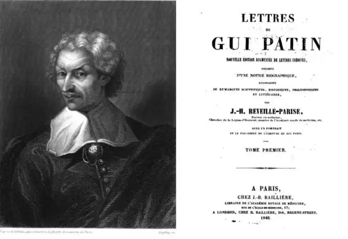 Каменные люди: фибродисплазия - история болезни.