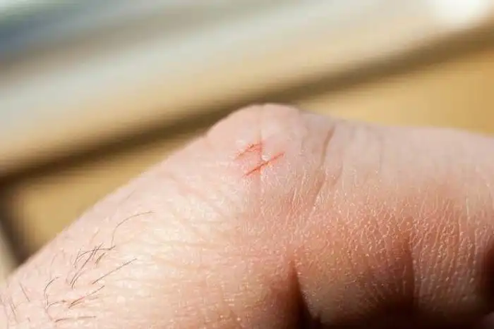 Порезы бумагой одни из самых болезненных. Почему?