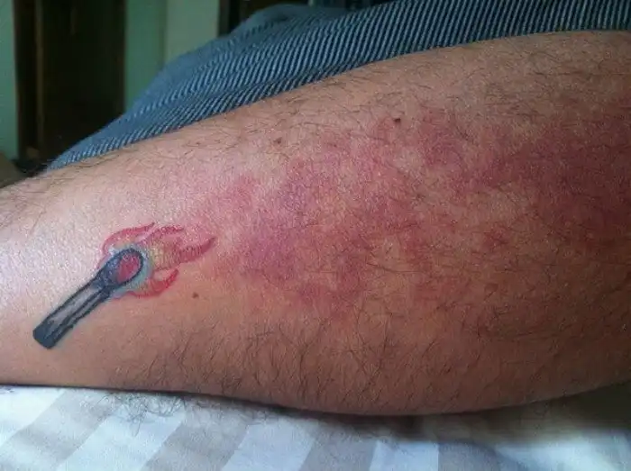 15 человек, которые блестяще превратили шрамы в татуировки