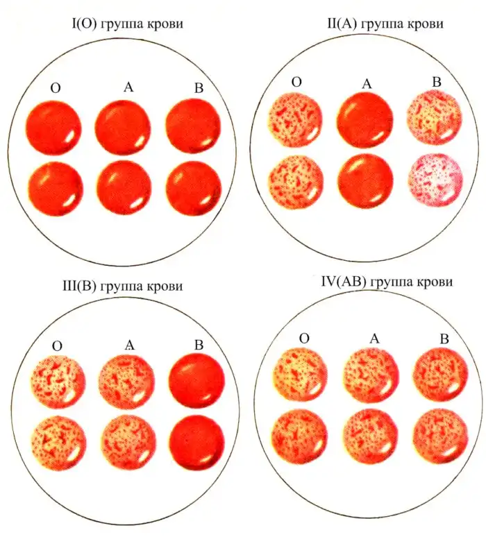 Группы крови — загадка 20 миллионов лет