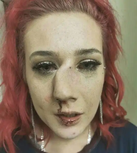 Незнакомец свернул нос девушке