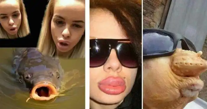 Бабьи накачанные губы и мужские мысли на эту тему