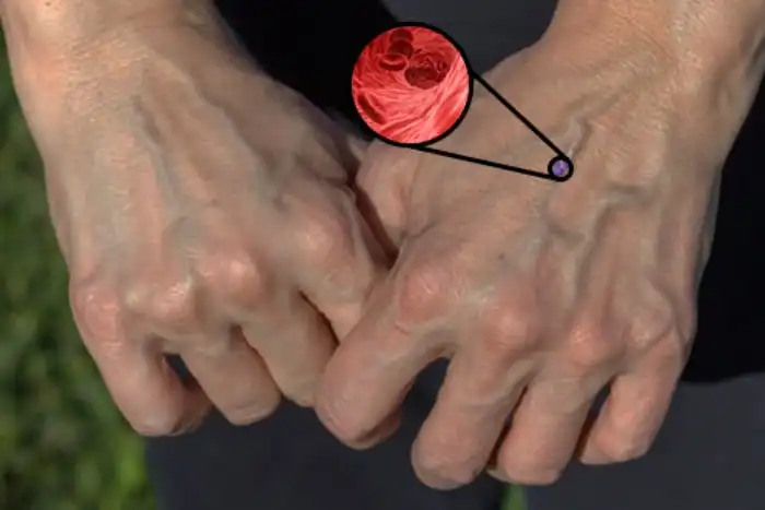 Если кровь красного цвета, то почему вены голубые?