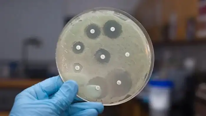 История пенициллина: как обычная плесень спасла миллионы жизней