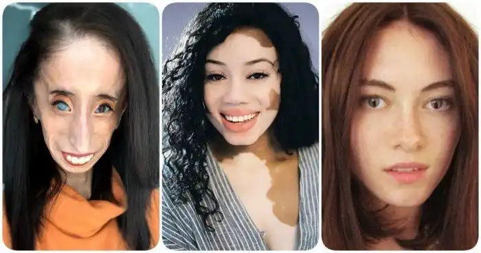 Люди с биологическими аномалиями, показывающие, как непредсказуема наша генетика