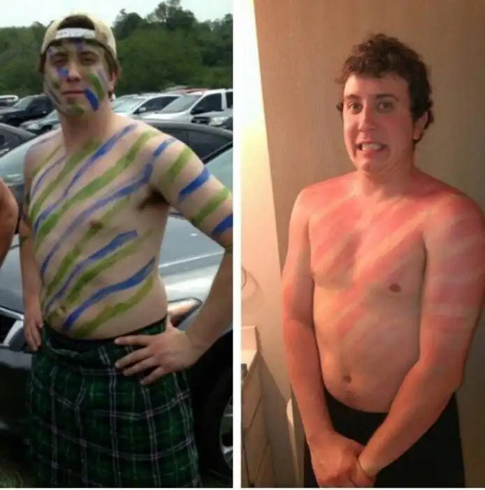 17 фотографий людей, которые перестарались с загаром