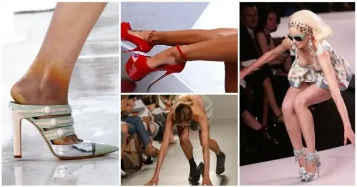 Обезображенные, вывихнутые и сломанные: самый сильный страх моделей