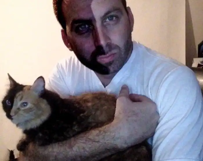 Одно тело на двоих. Что за таинственные люди-химеры и животные-химеры?