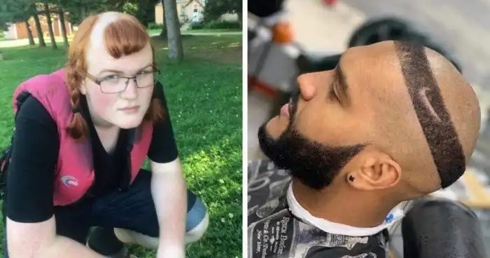 Волосы – не зубы, отрастут!