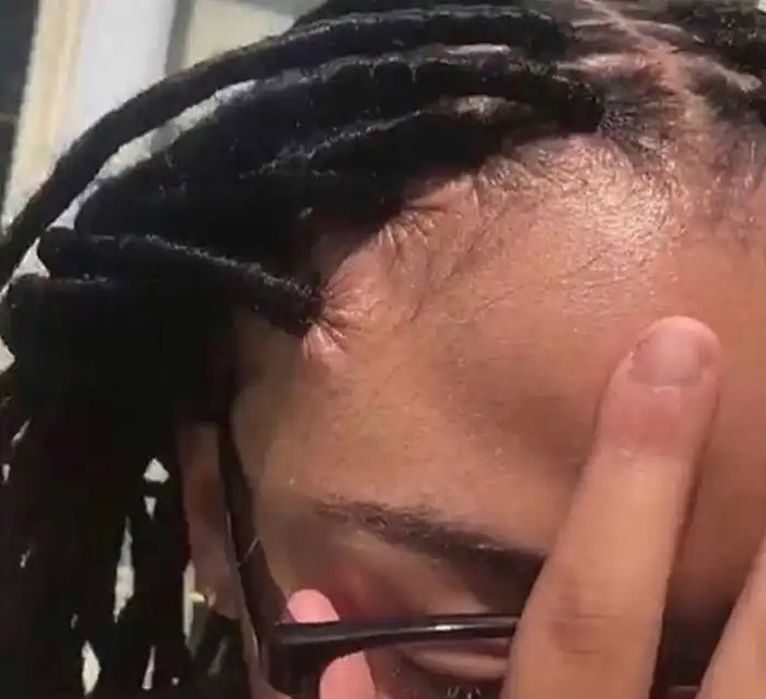 Волосы – не зубы, отрастут!