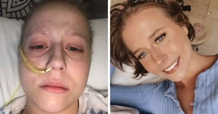 Люди, пережившие рак, рассказывают о том, с чего они начинали свою борьбу с болезнью