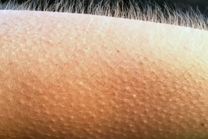 Доказательства эволюции, которые вы можете найти на своём теле