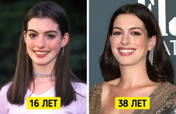 Знаменитости, которые отказались от "уколов красоты"