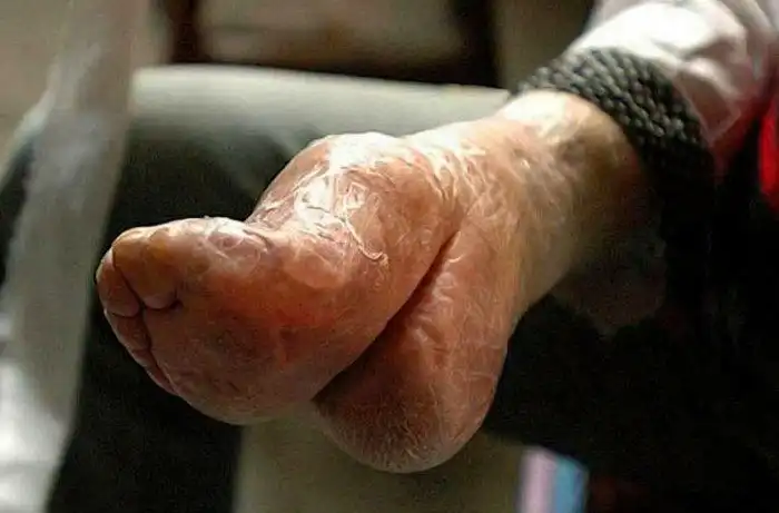 Ноги-лотосы: зачем китайские девушки уродовали свои ступни?