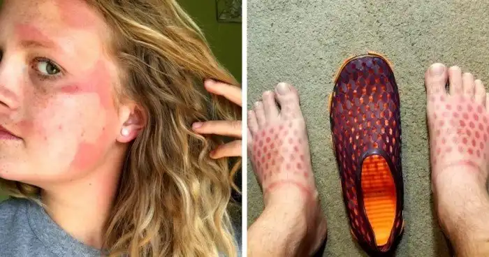 На это смотреть больно: 16 людей, которые перестарались с загаром