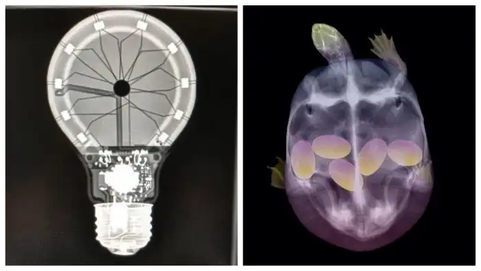 17 странных и необычных рентгеновских снимков