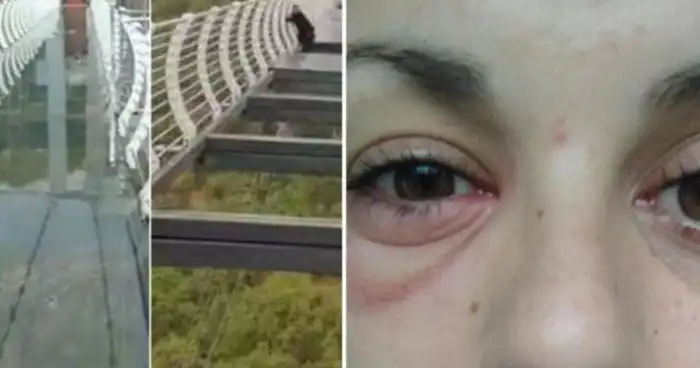 15 человек, у которых день сегодня - хуже некуда