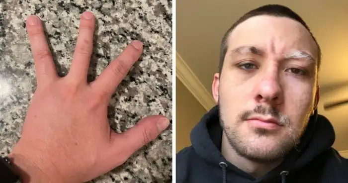 Люди с биологическими аномалиями: не мутация, а особенность