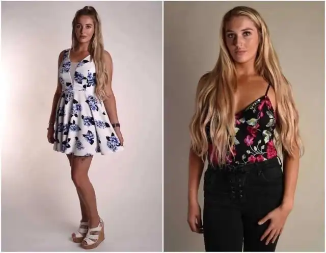 Эмбер Мэй - девушка из Великобритании, которая переборщила с пластикой так, что теперь не может завязать шнурки