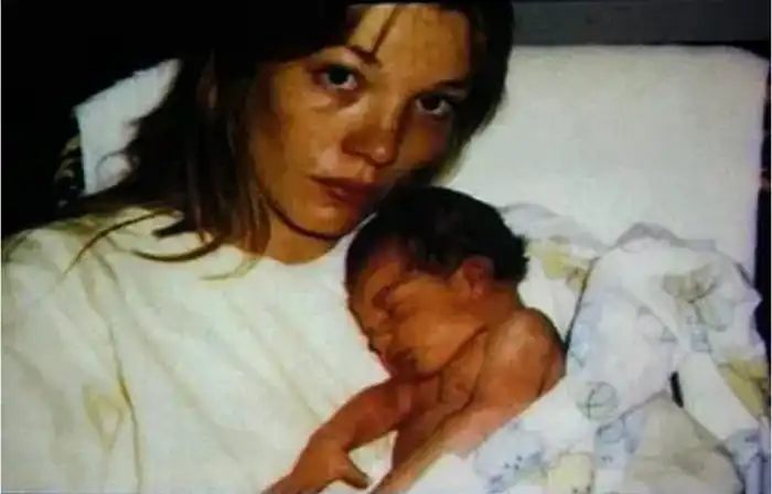 Впервые в истории врачи пересадили свиное сердце человеку