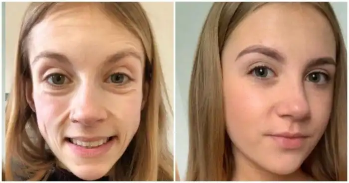 15 человек, которые кардинально изменились, и из гадких утят превратились в прекрасных лебедей