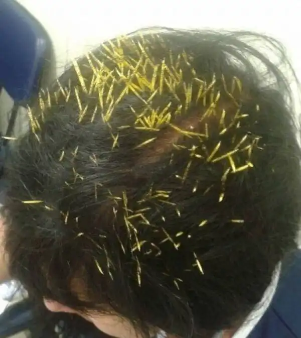 17 отчаявшихся горемык, чья жизнь - это череда катастроф