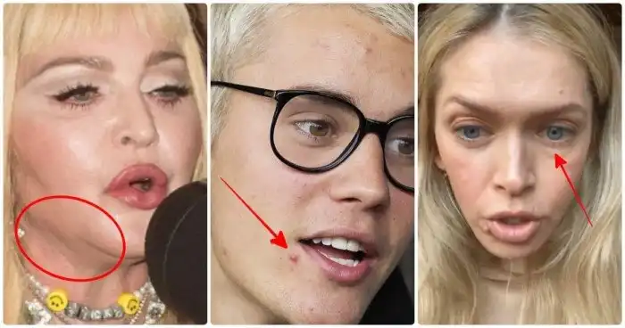 Звезды, кожа которых оставляет желать лучшего - но они не готовы показывать себя настоящих