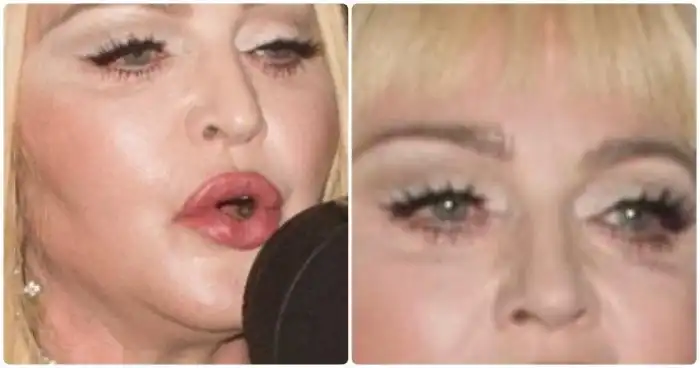 Звезды, кожа которых оставляет желать лучшего - но они не готовы показывать себя настоящих