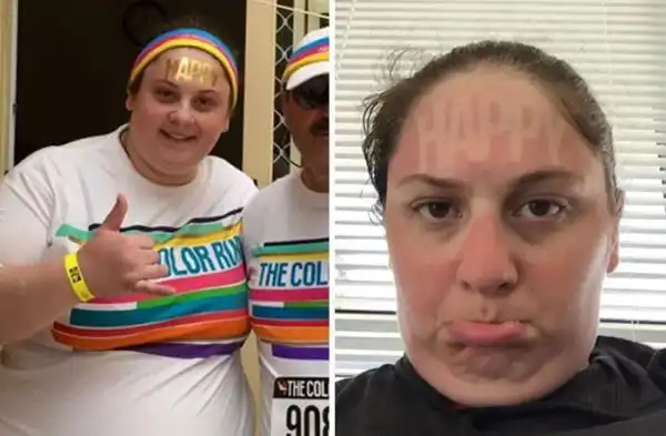 "Солнечные ванны", которые обернулись полным фиаско