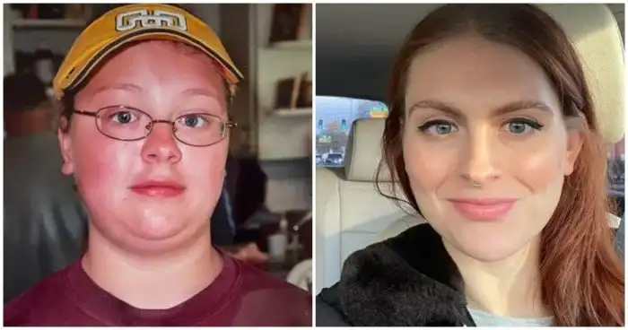 15 людей, которых все считали гадкими утятами, но они сломали систему - и теперь выглядят прекрасно