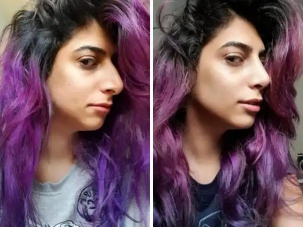 Случаи, когда пластические операции творят чудеса