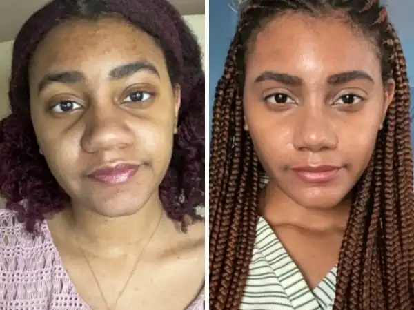 Случаи, когда пластические операции творят чудеса