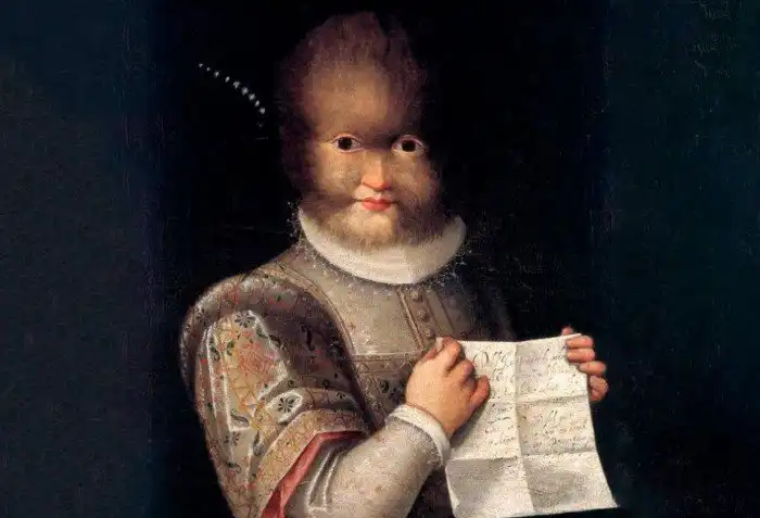 Простолюдин, покрытый шерстью. Кто стал прототипом персонажей сказки «Красавица и чудовище»?