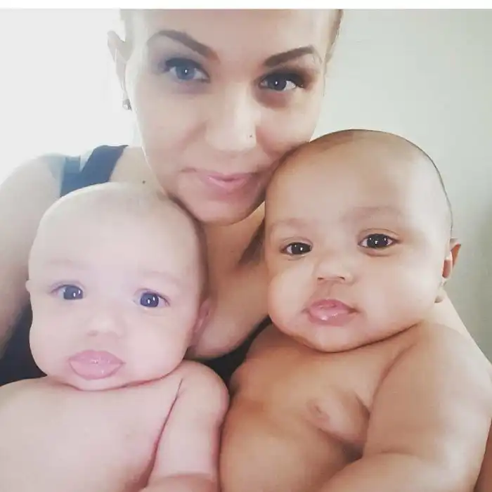 Как сейчас выглядят двухрасовые близнецы, в родство которых никто не верил из-за разного цвета кожи