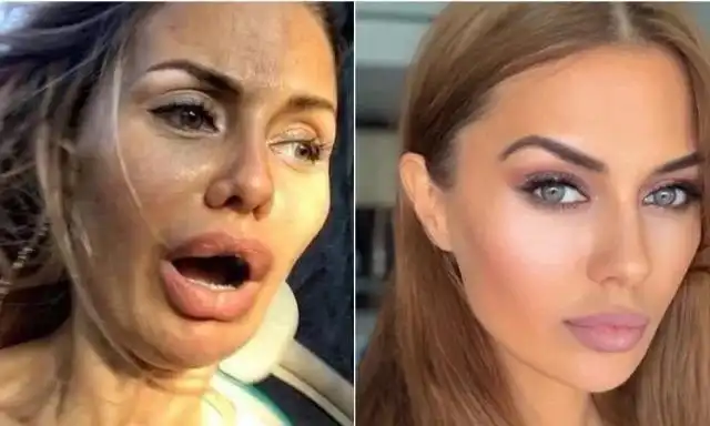 Жестокая реальность: 9 красоток, которые в обычной жизни — "серость обыкновенная"