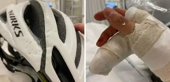 Эти картинки напомнят вам, зачем нужно носить шлем