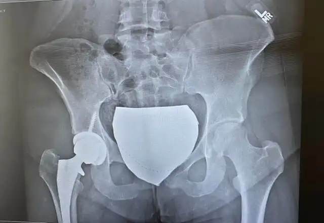 20 злополучных человек, с которыми произошли тридцать три несчастья