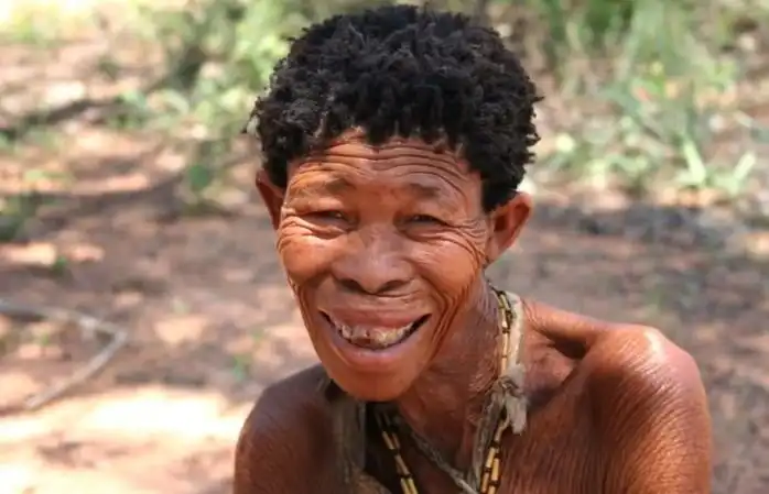 Первая раса на земле, которой приходилось работать в цирке "уродов" из-за странной внешности