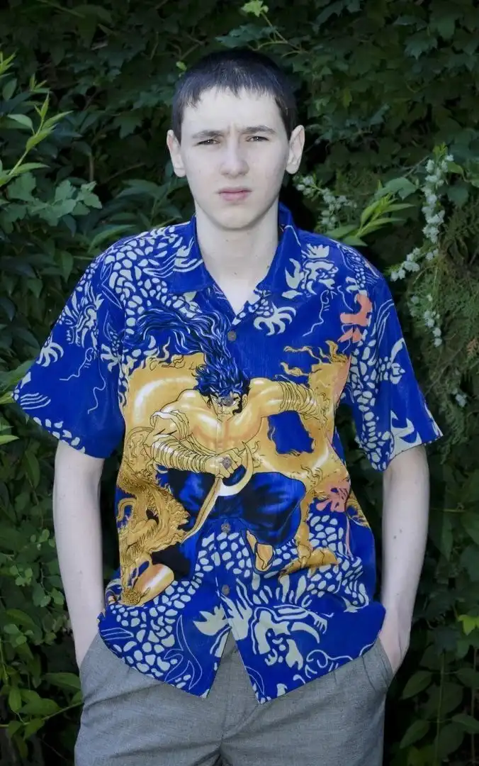 Чем живет "руки-базуки", который влил в свои бицепсы 6 литров "синтола" и как это отразилось на руках