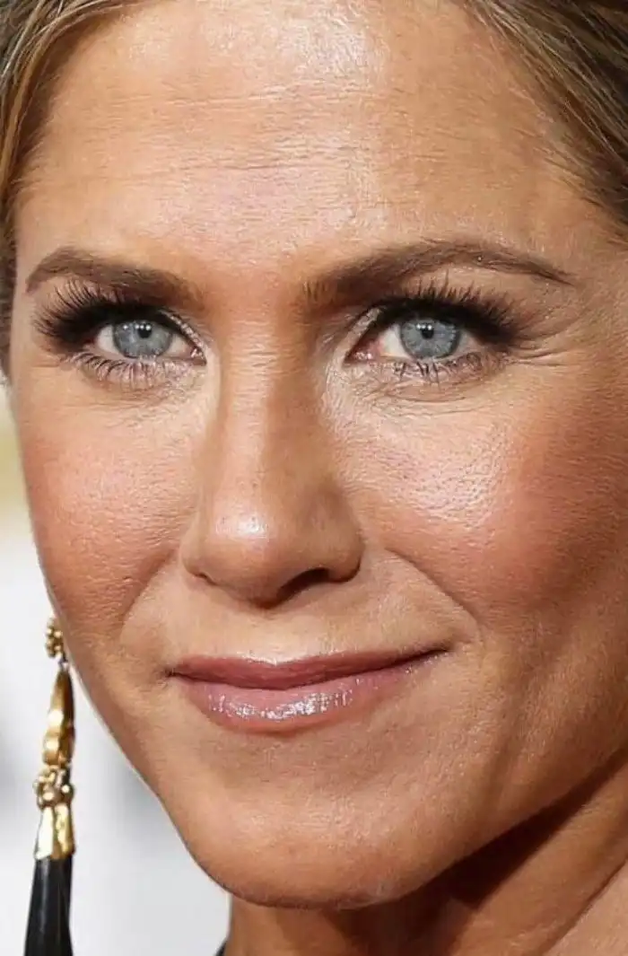 Мешки под глазами и прыщи: как на самом деле выглядит кожа знаменитостей без обработки