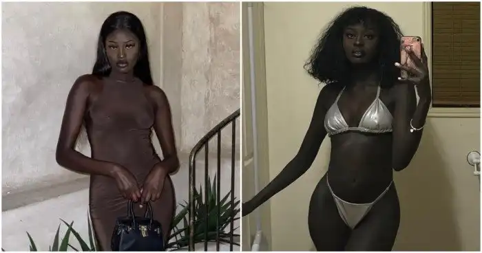 Что стало с моделью, которая 2 года назад поразила всех своей темной кожей