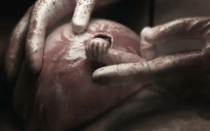 Удивительная история мальчика с фотографии «Рука надежды»: по чистой случайности его удалось спасти