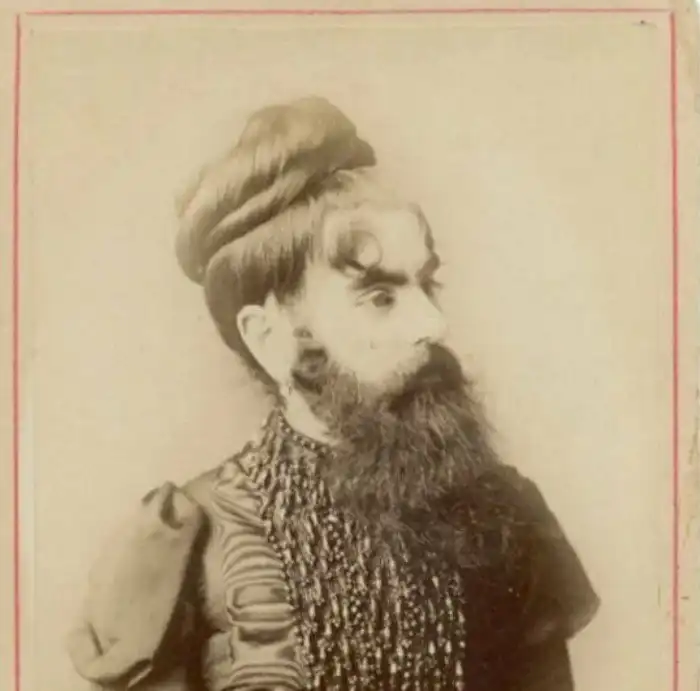 Подарок судьбы или проклятие: трагичная судьба бородатой женщины Энни Джонс