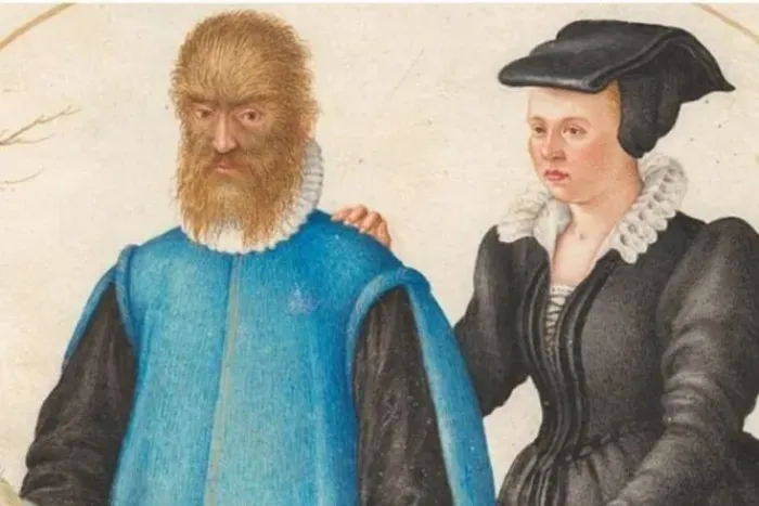 «Волосы у него напоминают мех соболя и приятно пахнут». Реальная история чудовища из «Аленького цветочка»