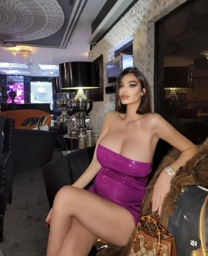 Фотошоперы, которые до смешного переборщили с редактированием снимков