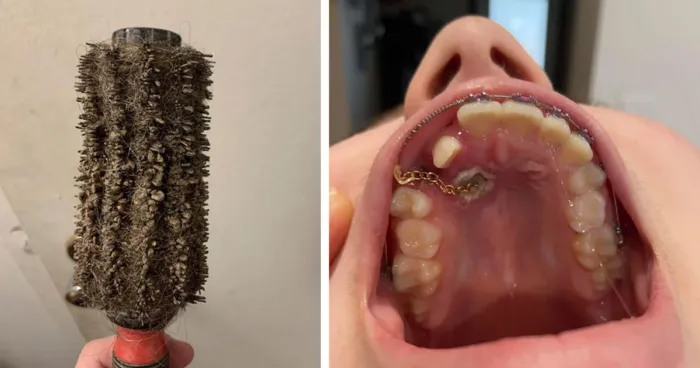 30 омерзительных фото, которые хочется немедленно развидеть