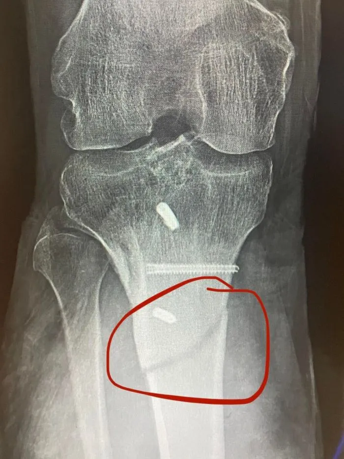 И смех и грех: 30 людей, чей день определённо не задался