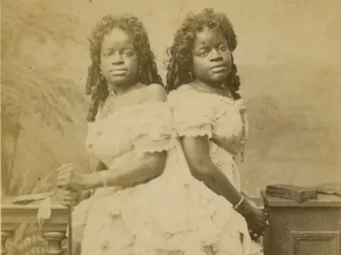 Как две чернокожие сросшиеся рабыни смогли прожить удивительную жизнь