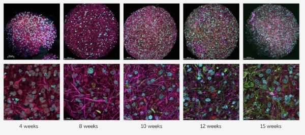Мозги в тарелке: учёные работают над созданием органоидного интеллекта. В чем биокомпьютеры могут быть лучше традиционного ИИ?